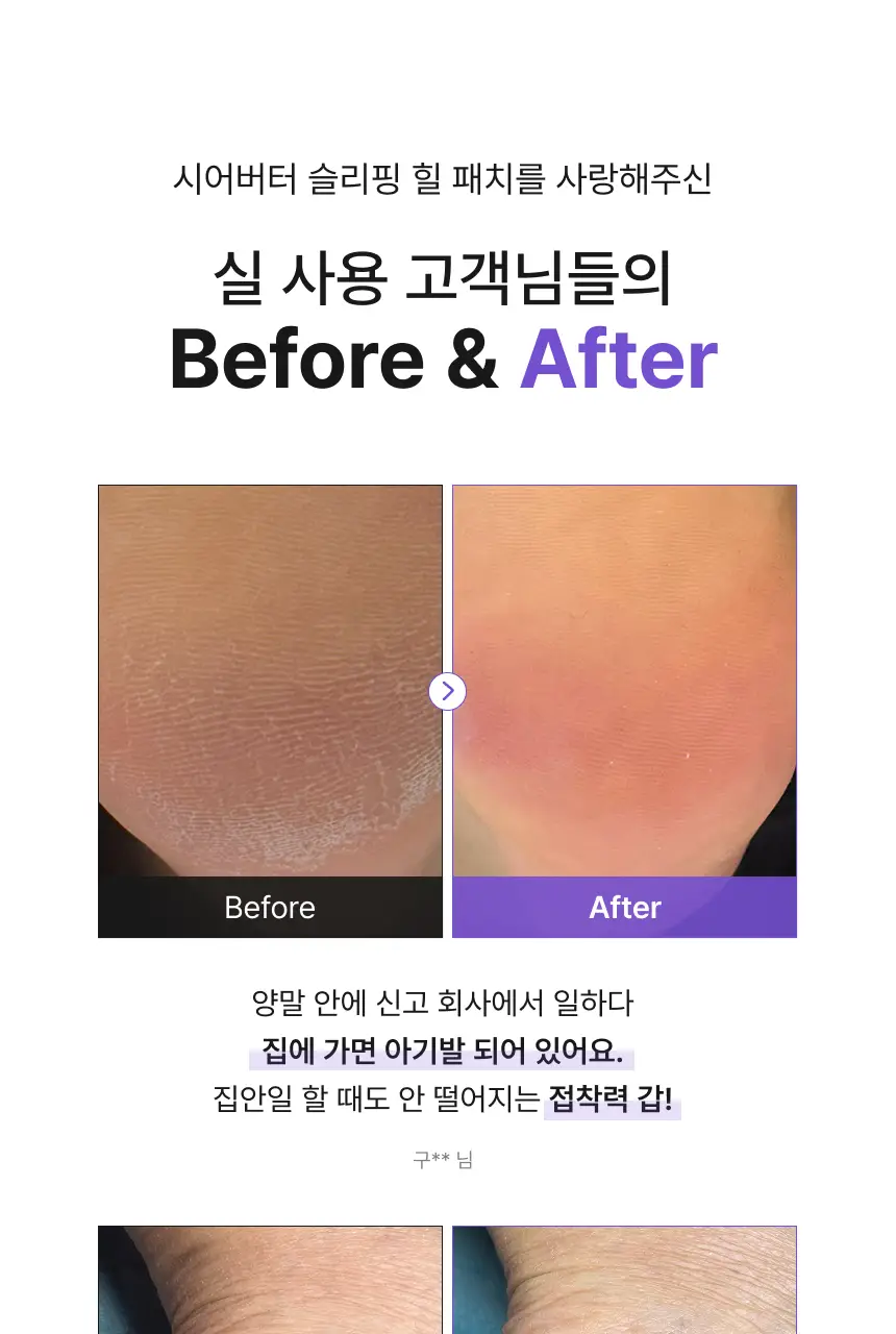 [특별한정/1위 버터패치] 바렌 시어버터 슬리핑 힐 패치 6매입 기획 (+미니풋파일) 상세페이지 12